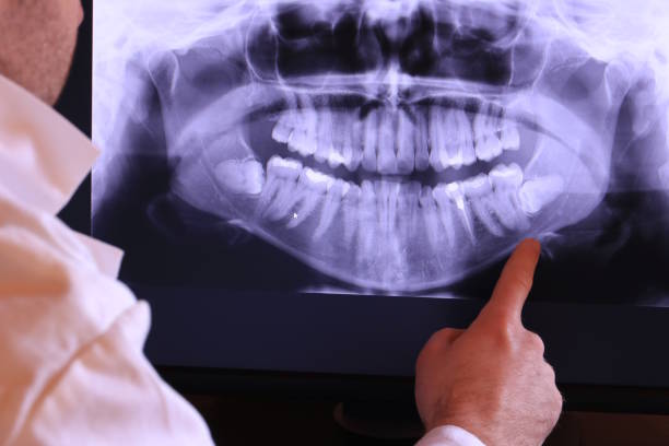 Best Emergency Dental Care for Broken or Chipped Teeth in Scanlon, MN